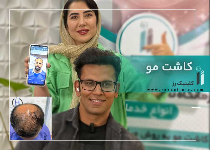 مرکز کاشت مو در  شیراز | کلینیک رز
