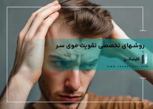 تقویت موی سر مردان