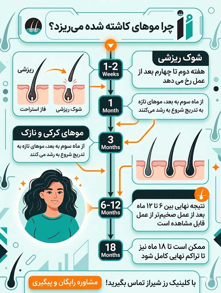 چرا موهای کاشته شده میریزد