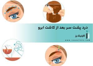 Back pain after eyebrow transplant