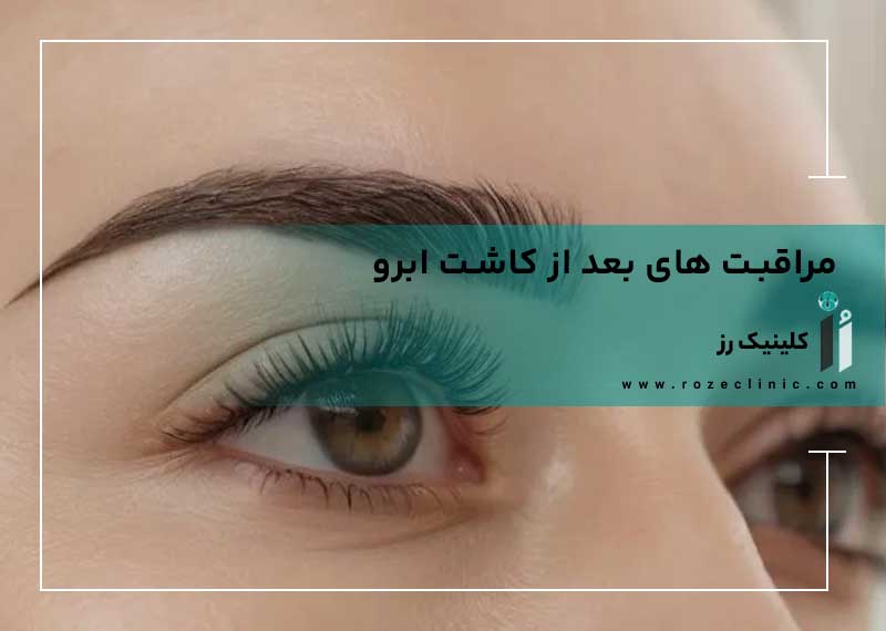 مراقبت های بعد از کاشت ابرو