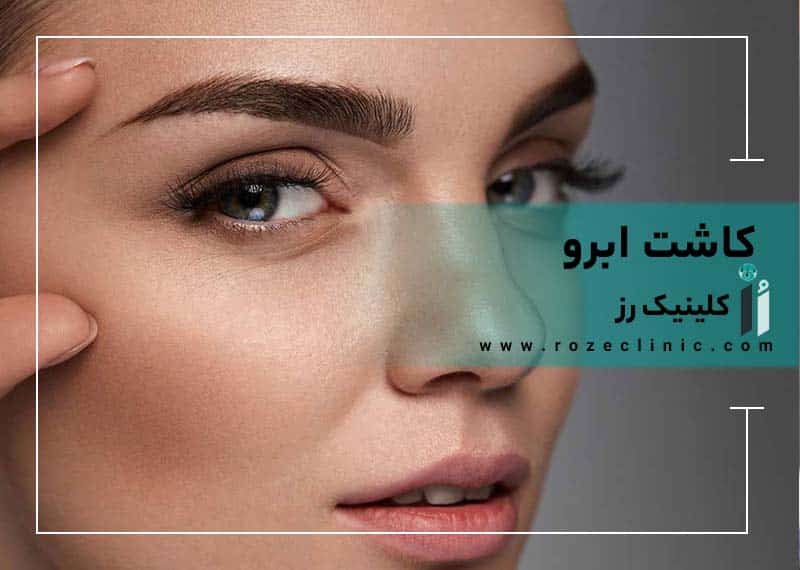 کاشت ابرو در شیراز