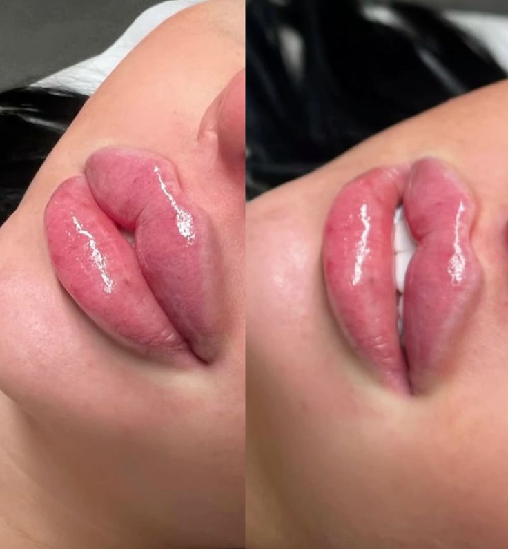مدل ژل لب قلبی