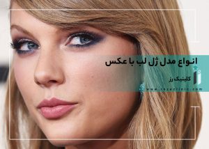 انواع مدل ژل لب با عکس