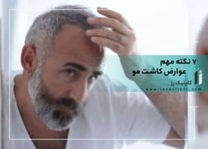 7 نکته مهم در مورد عوارض کاشت مو