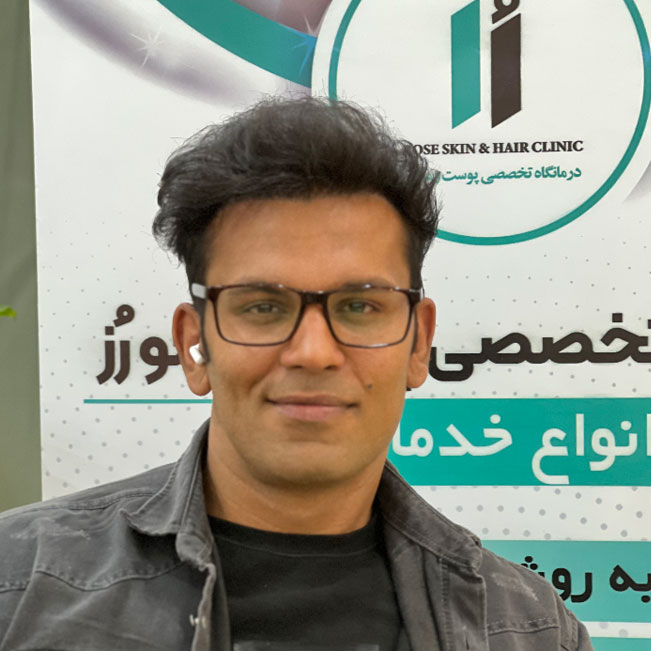 بعد از کاشت مو در کلینیک رز