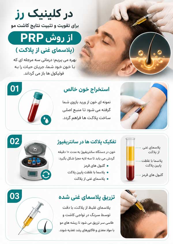 پی آر پی پس از کاشت مو