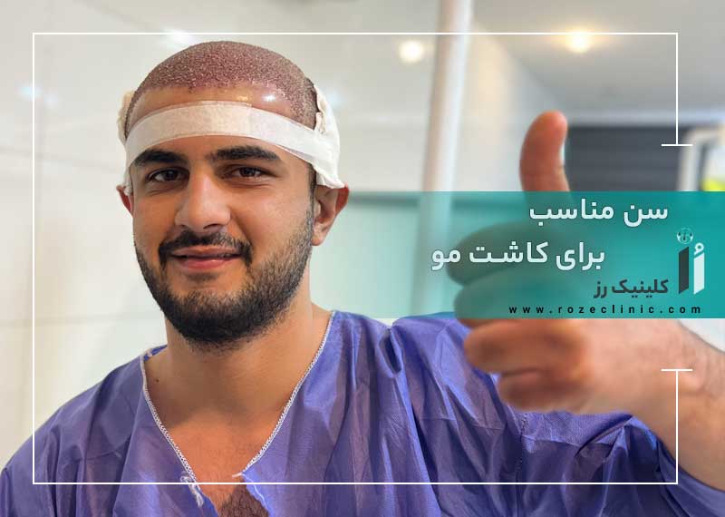 سنِ مناسب برای کاشت مو: سن تنها معیار نیست