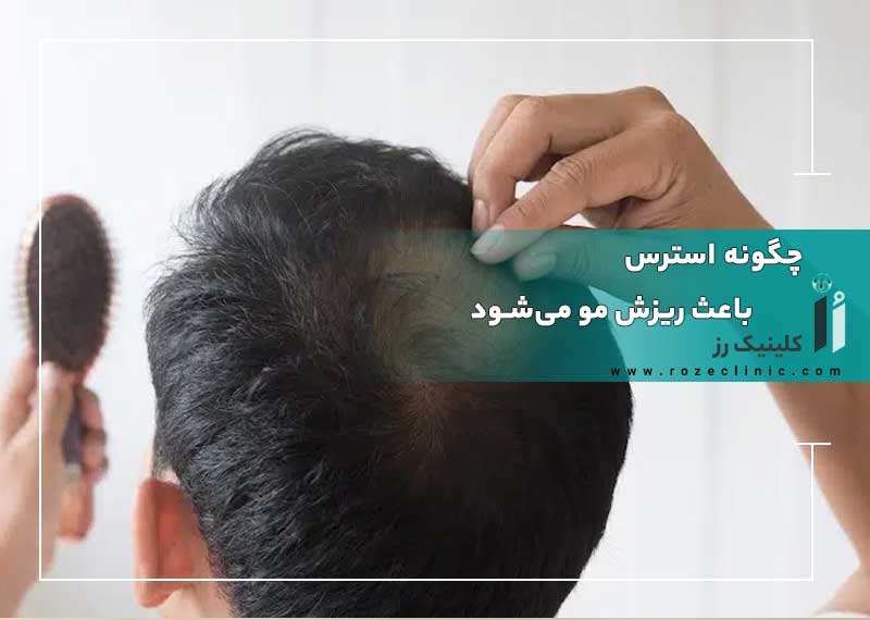 چگونه استرس باعث ریزش مو می‌شود