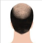 تصویر برای شماره انتخاب 2