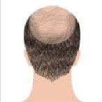 تصویر برای شماره انتخاب 6